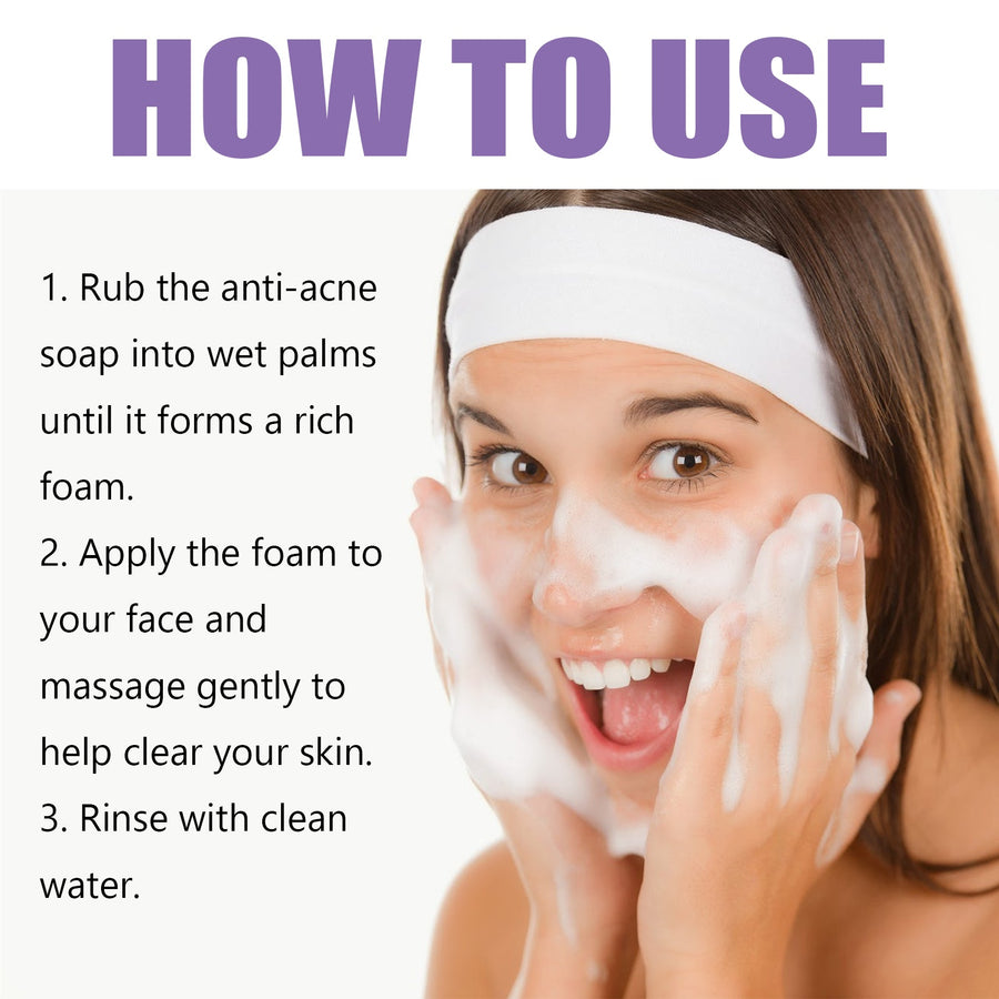 Lavender Acne Soap Bar For Oily Skin Pore Control