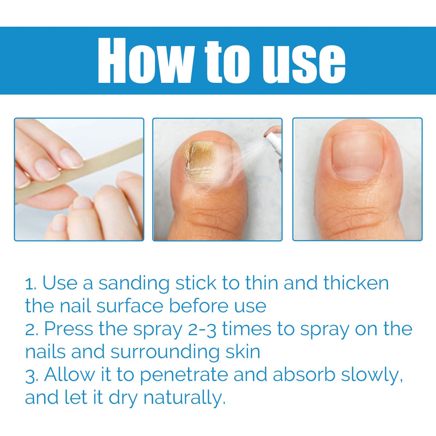 Anti-Fungal Nail Spray — Eliminates Fungus & Restores Clear Nails