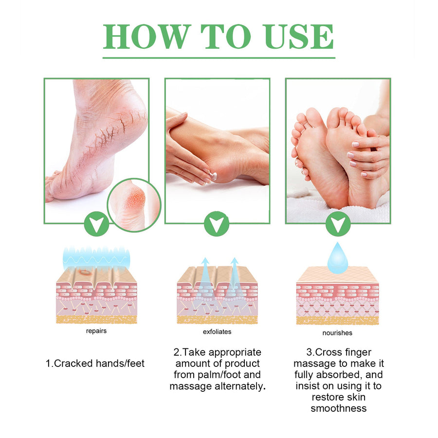 Cracked Heel Repair Cream for Dry Hands and Feet