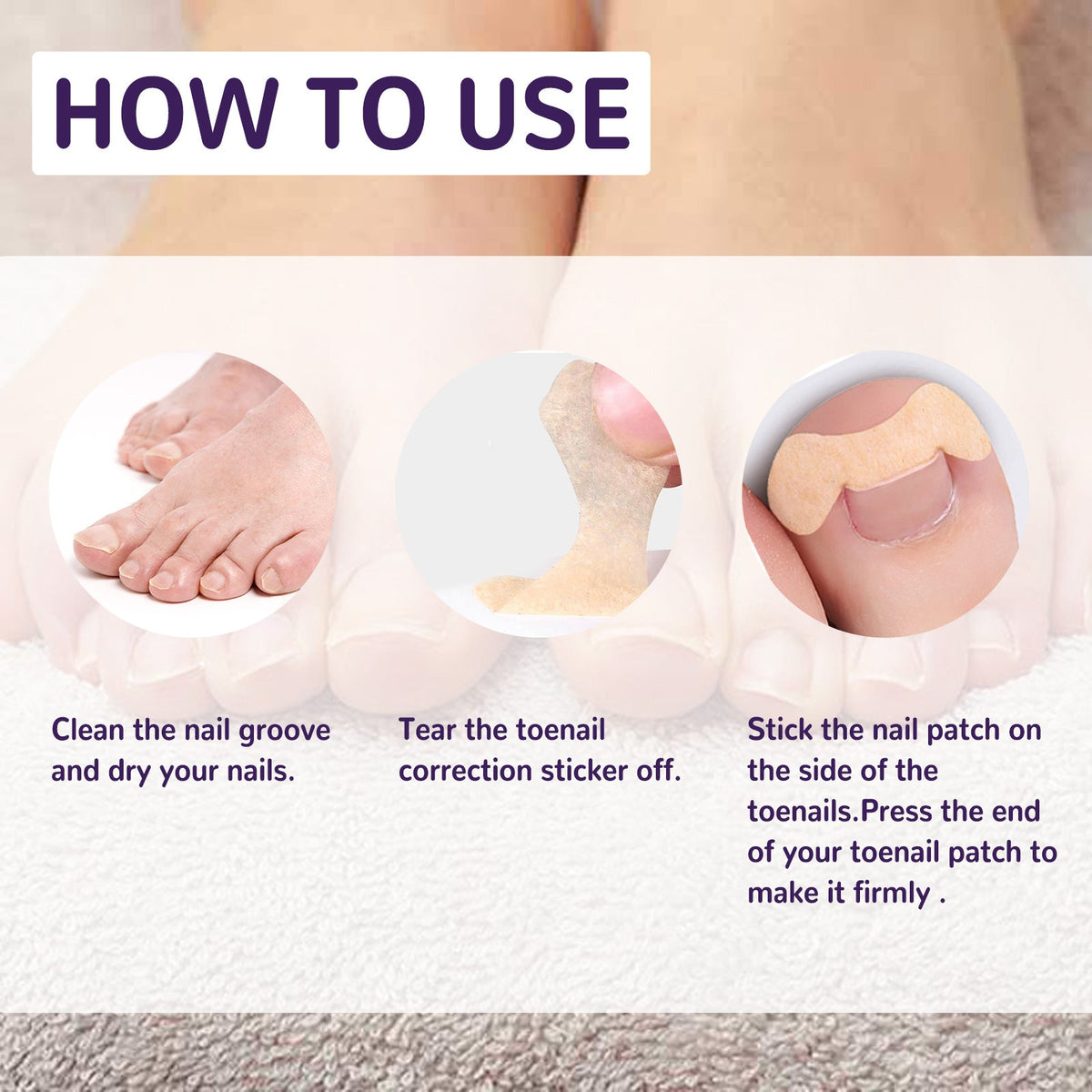 Elastic Toenail Correction Patch for Ingrown Nail Relief