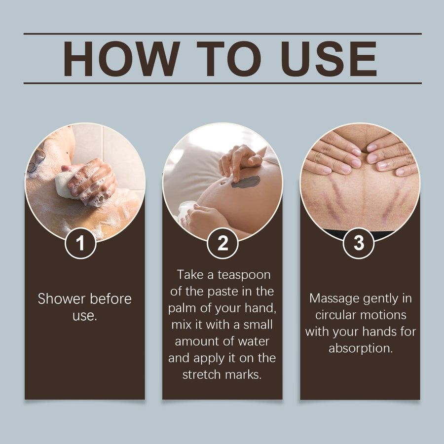Post-Natal Body Cream for Stretch Mark Repair & Elasticity