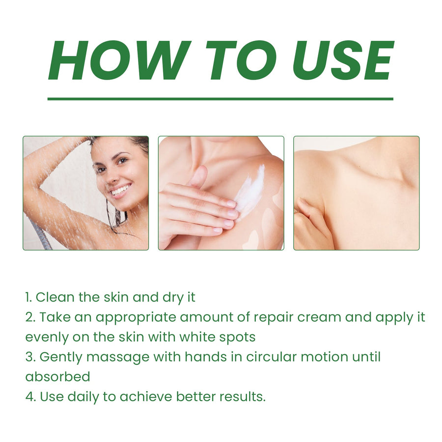 Vitiligo Cream — Restore Melanin & Even Skin Tone