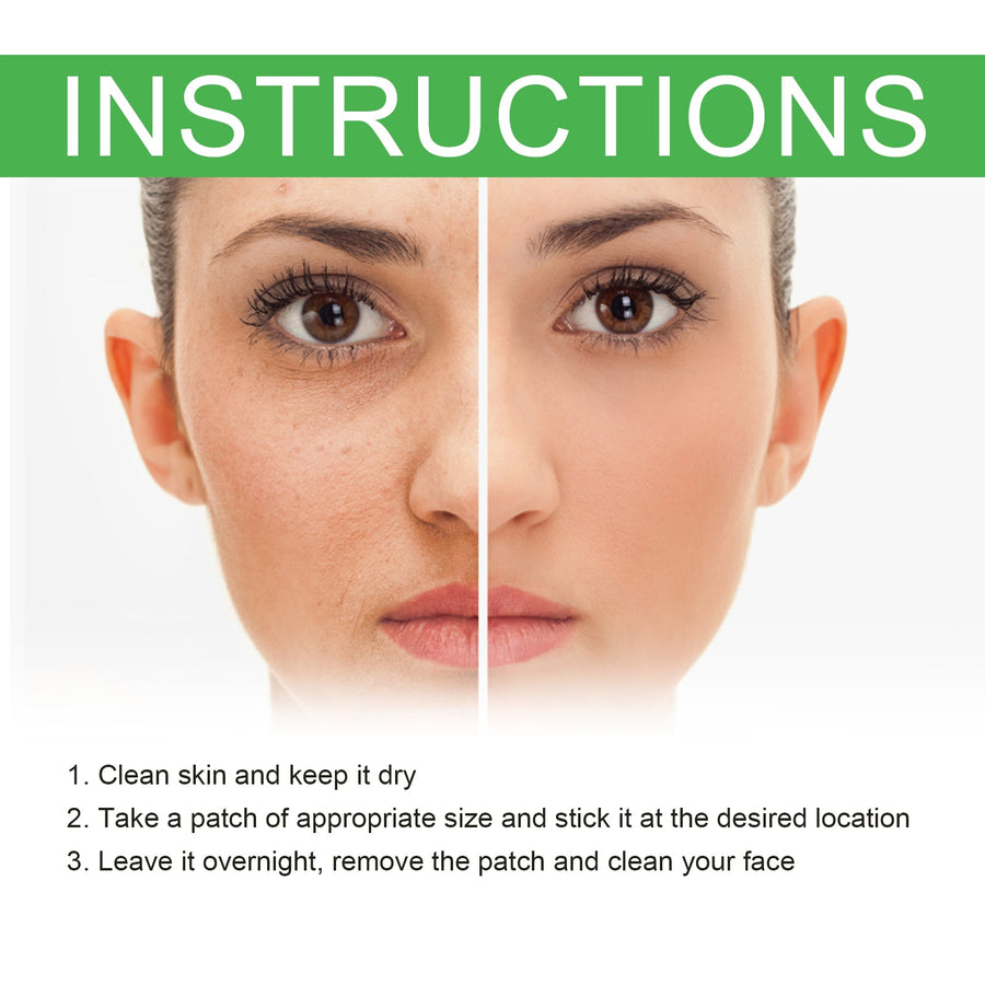 Overnight Acne Patches - Hydrocolloid Pimple Treatment