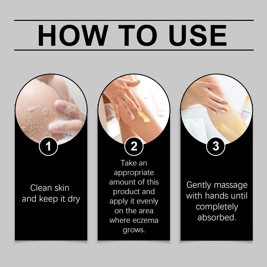 Herbal Eczema Cream – Soothes Dry, Itchy Skin on Hands & Feet