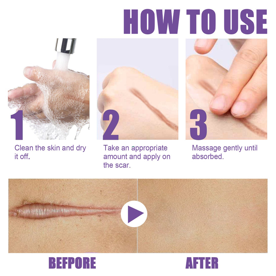 Skin Repair Cream — Visibly Fade Acne Scars & Stretch Marks