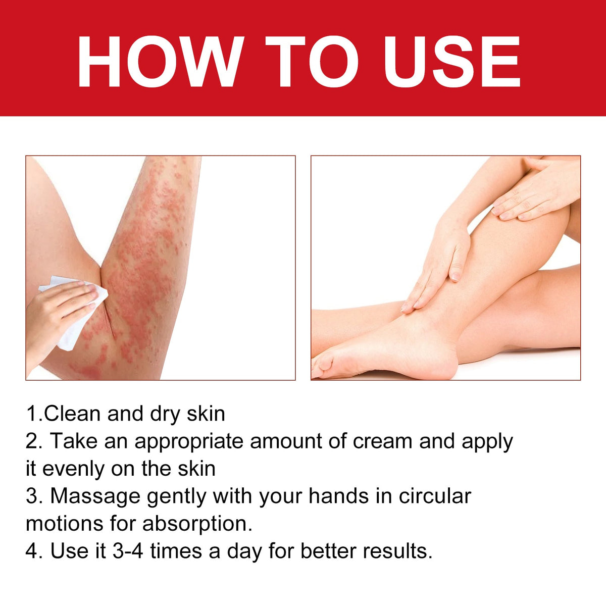 Ultra Soothing Cream for Bug Bites & Itchy Rash Relief