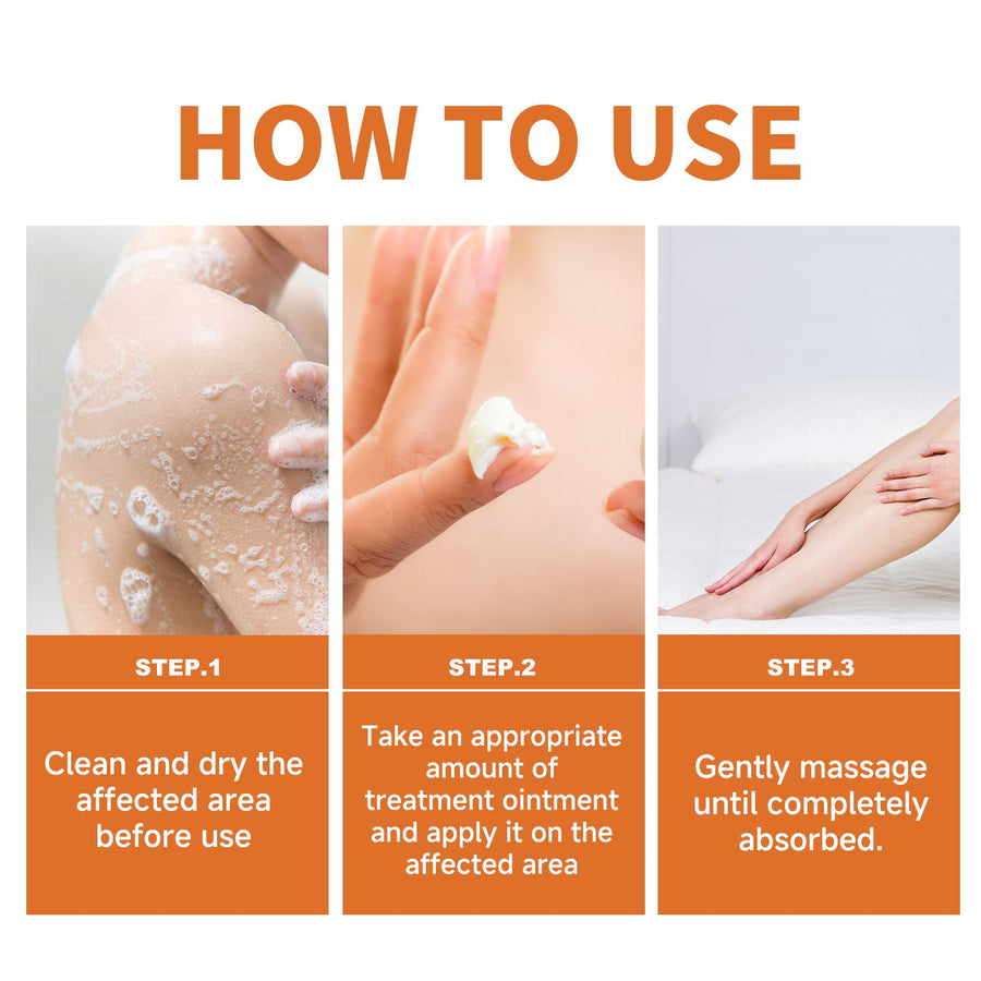 Psoriasis Cream with Bee Venom – Soothes Itch & Repairs Skin