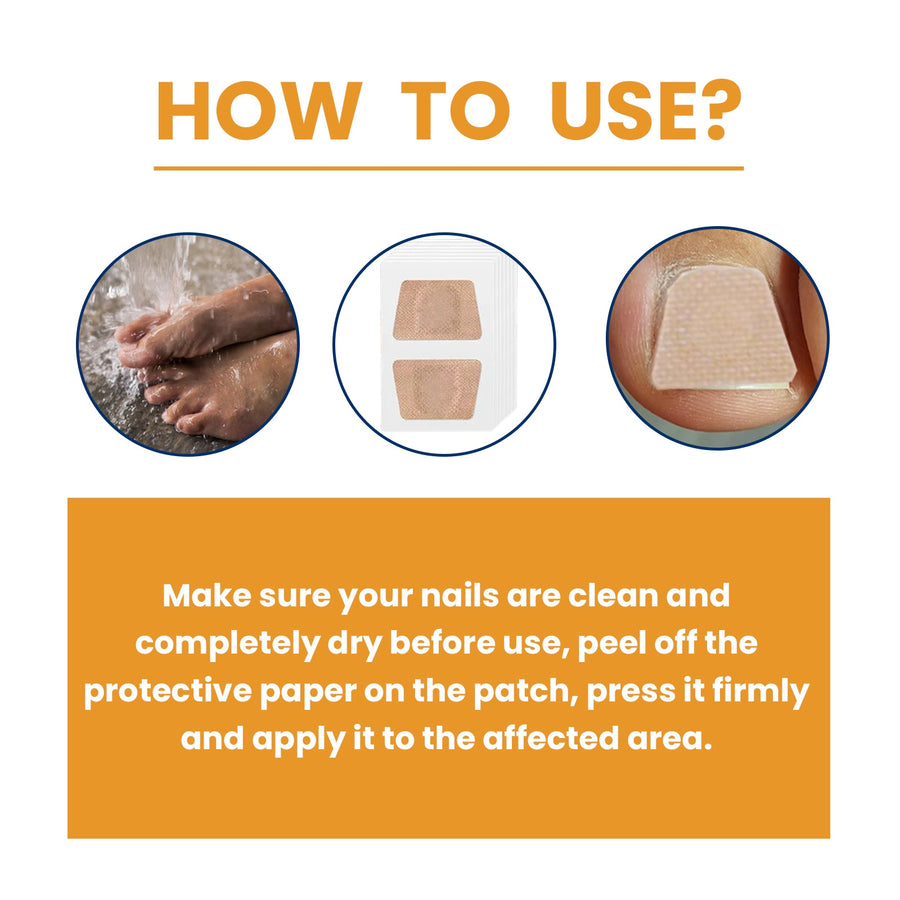 Fungal Nail Patches — Overnight Renewal for Clearer Nails