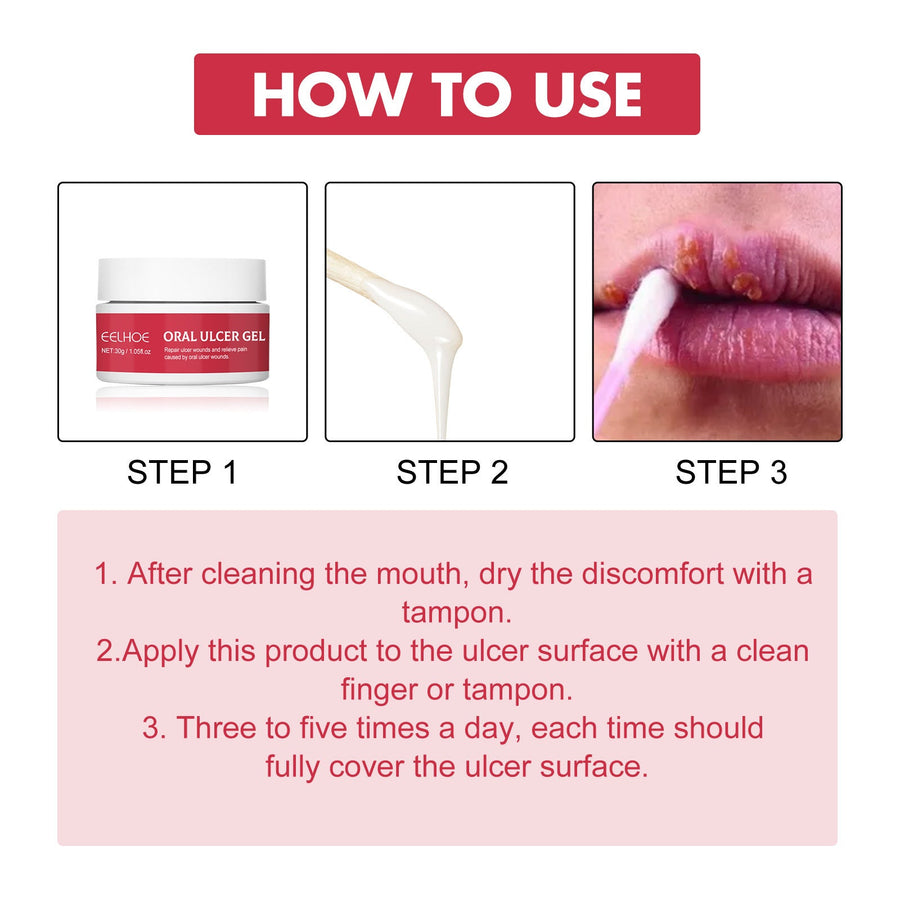 Oral Ulcer Repair Gel — Fast Relief for Mouth Sores & Gum Pain