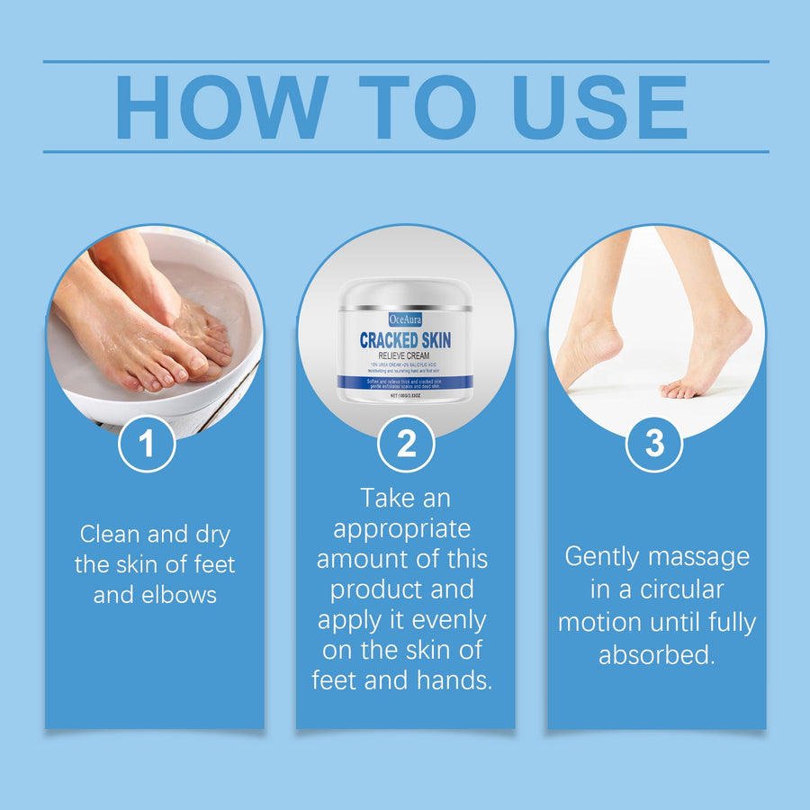 Urea Cream 10% for Cracked Heels, Hands & Elbows