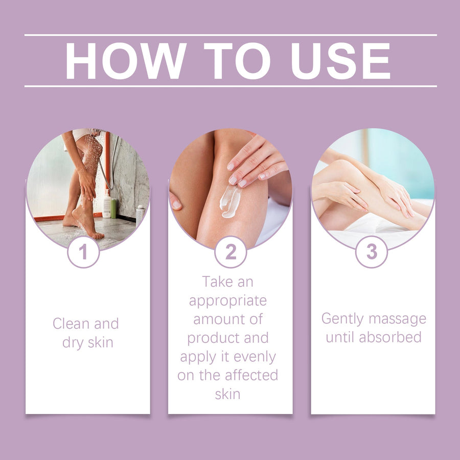 Varicose Veins Cream — Up to 8 Hours of Targeted Leg Pain