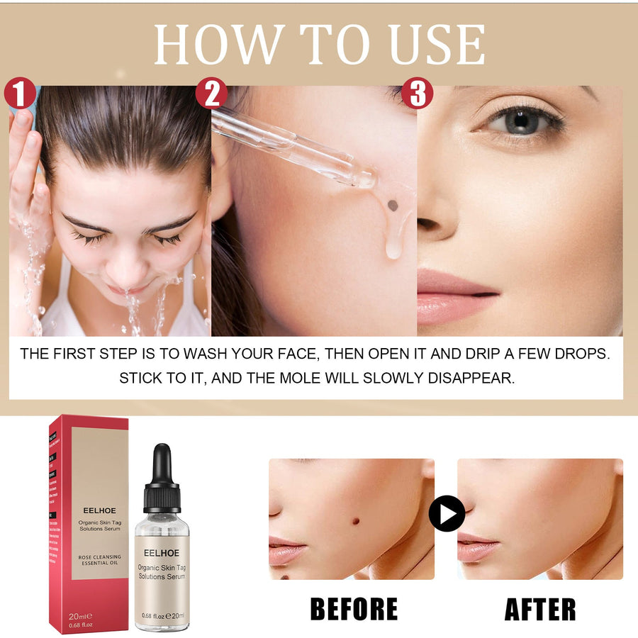 Organic Skin Tag Removal Serum – Clear, Smooth Skin in Weeks