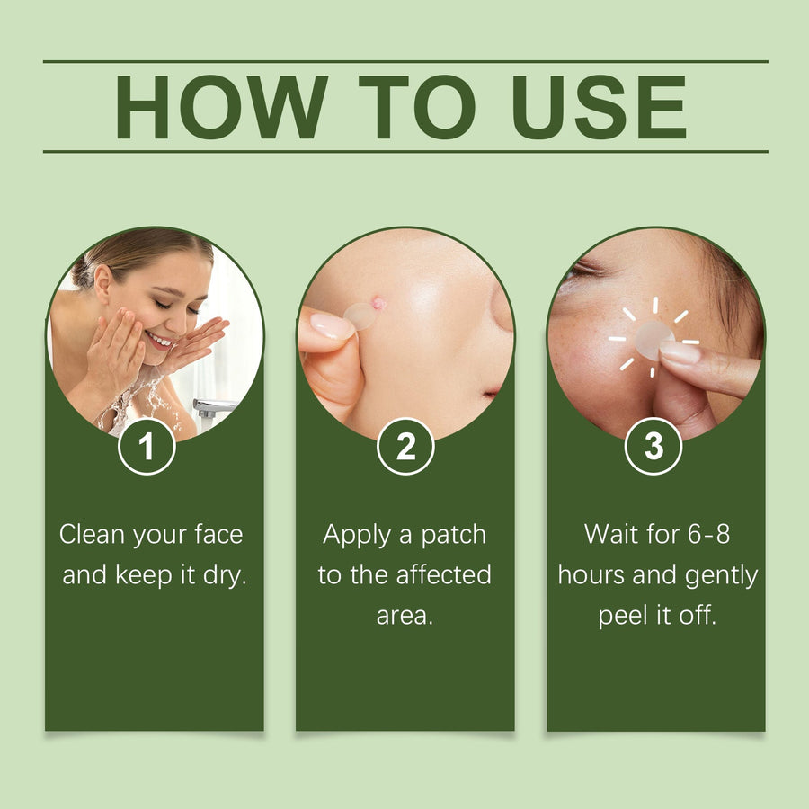 Anti-Acne Patches - Gentle Herbal Blemish Spot Treatment