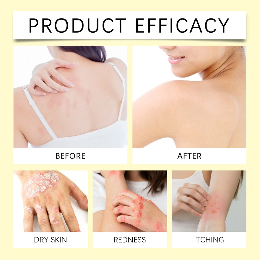Skin Repair Patch, Moisturizing Skin And Hands And Feet, Ski