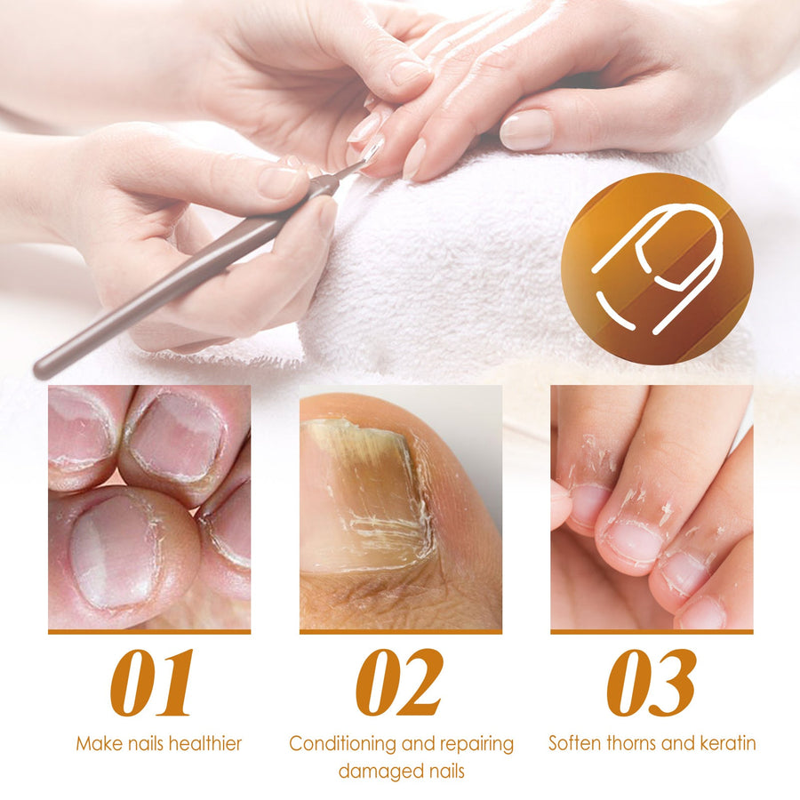 Cuticle Treatment Gel — Softer, Healthier Nails in 15 Seconds