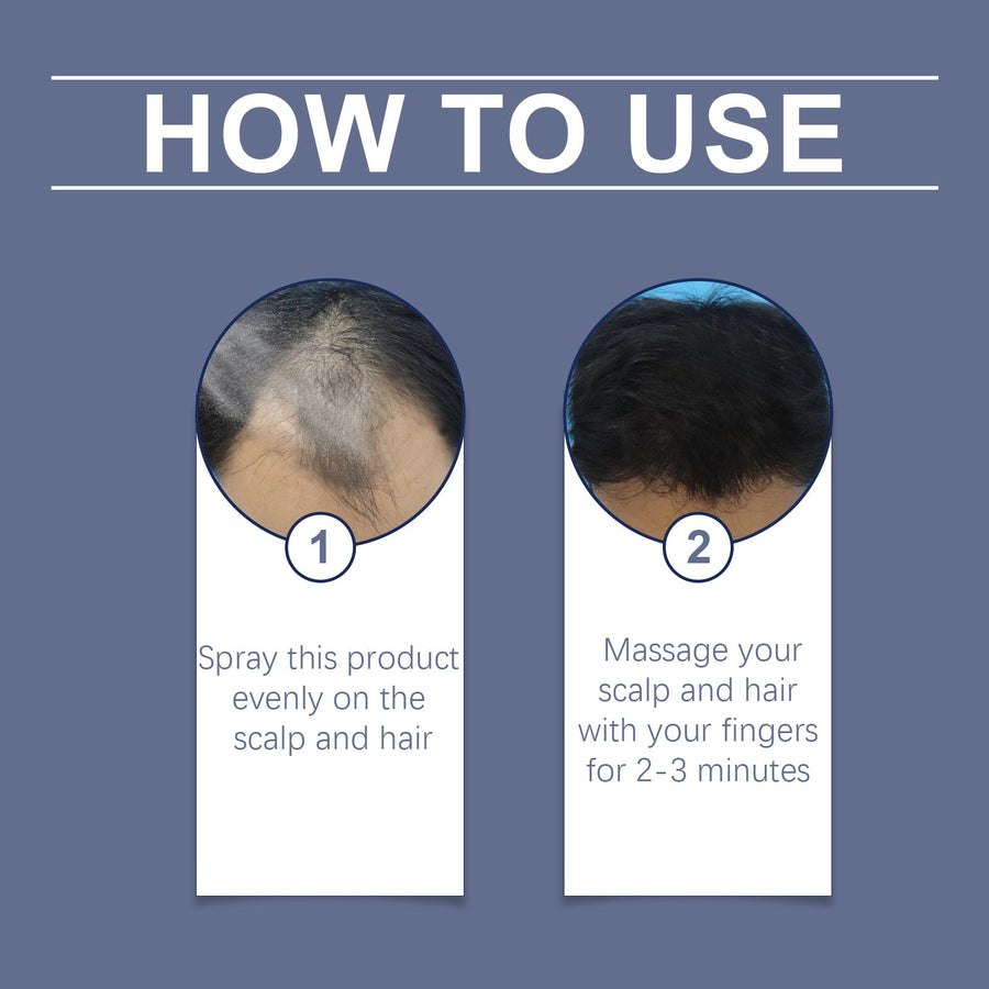 5% Hair Regrowth Spray for Men & Women, 60ml Scalp Care