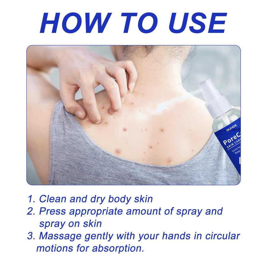 Porecare Skin Care Spray, Cleanser Warts Fade Moles Corns Sm