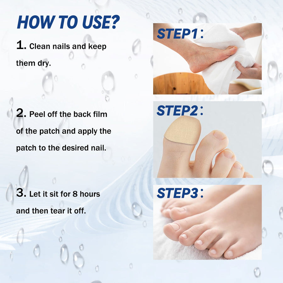 Fungal Nail Patches, Repair Thickening Gray Nail Rotten Nail