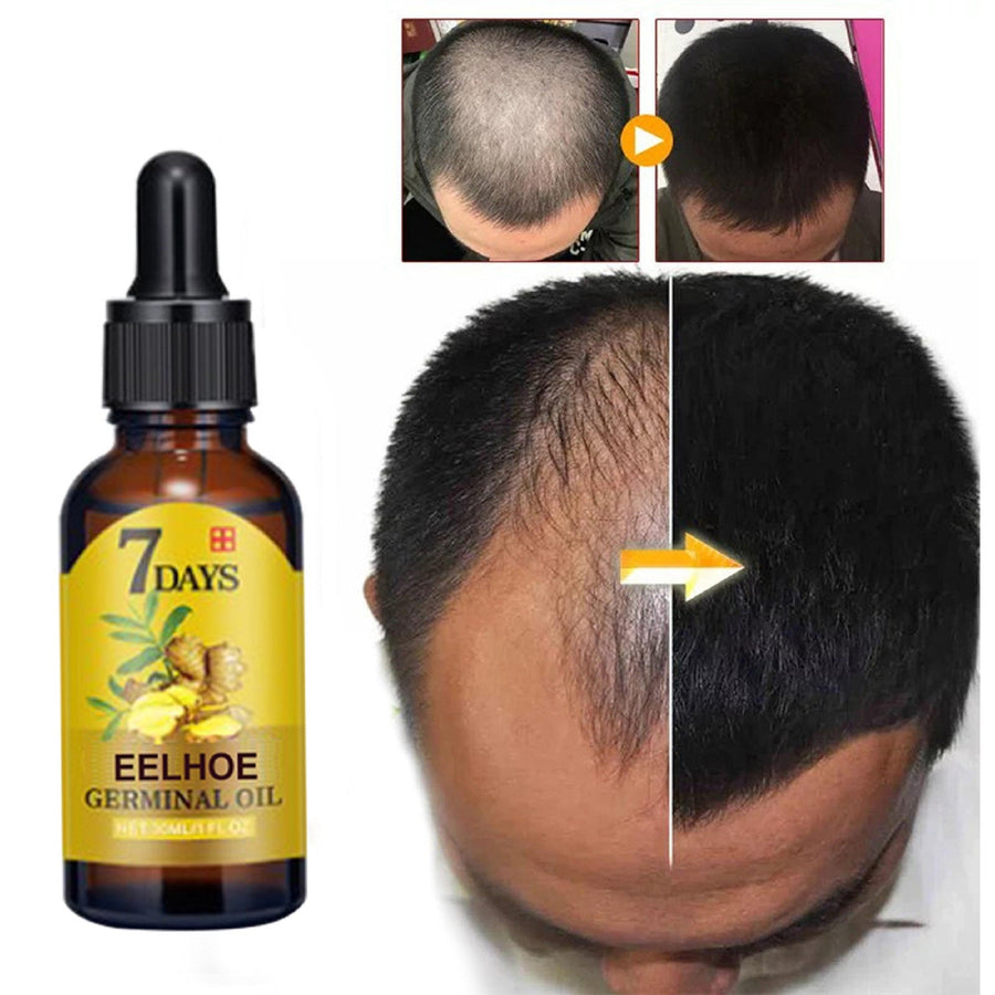 Ginger Hair Oil for Nourishing and Moisturizing Hair