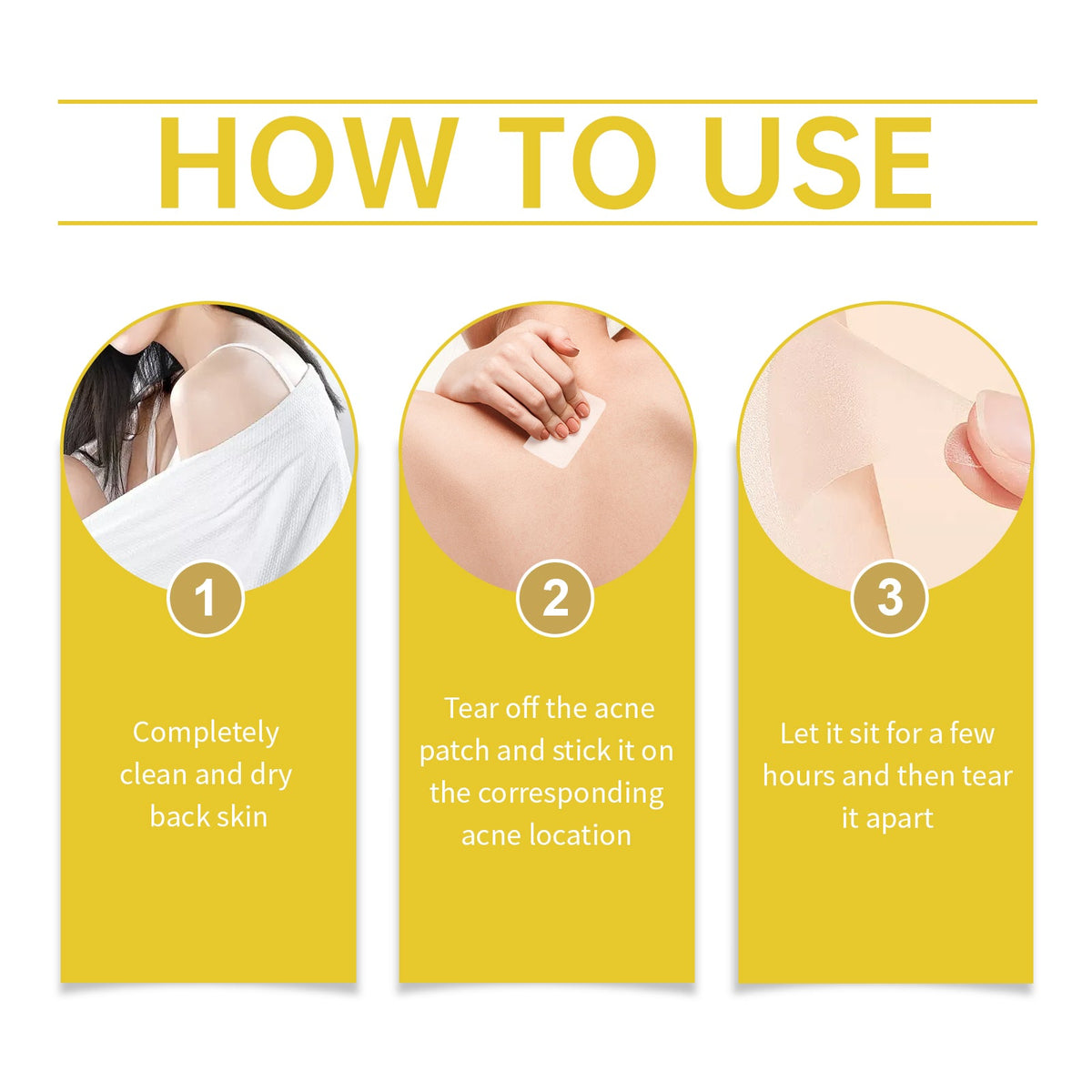 Back Acne Patches with Microdarts for Fast Clearing