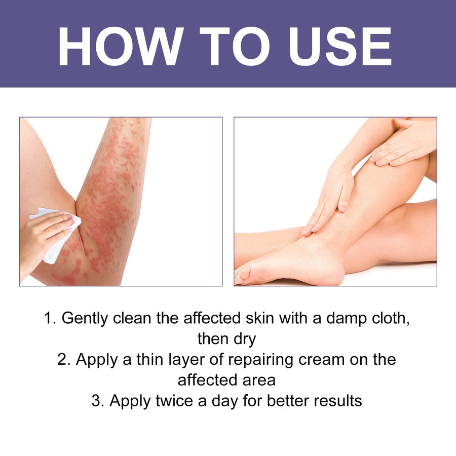 Anti-Fungal Rash Cream – 3-Day Relief & Instant Cooling