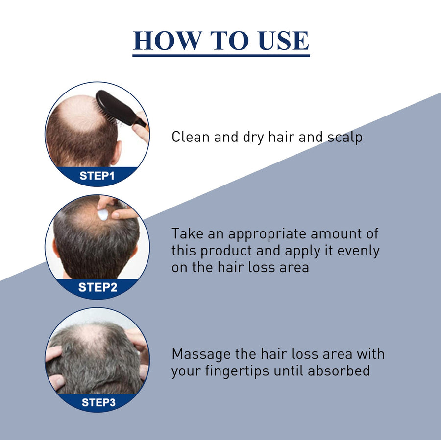 Scalp Hair Growth Cream for Thinning and Oily Roots