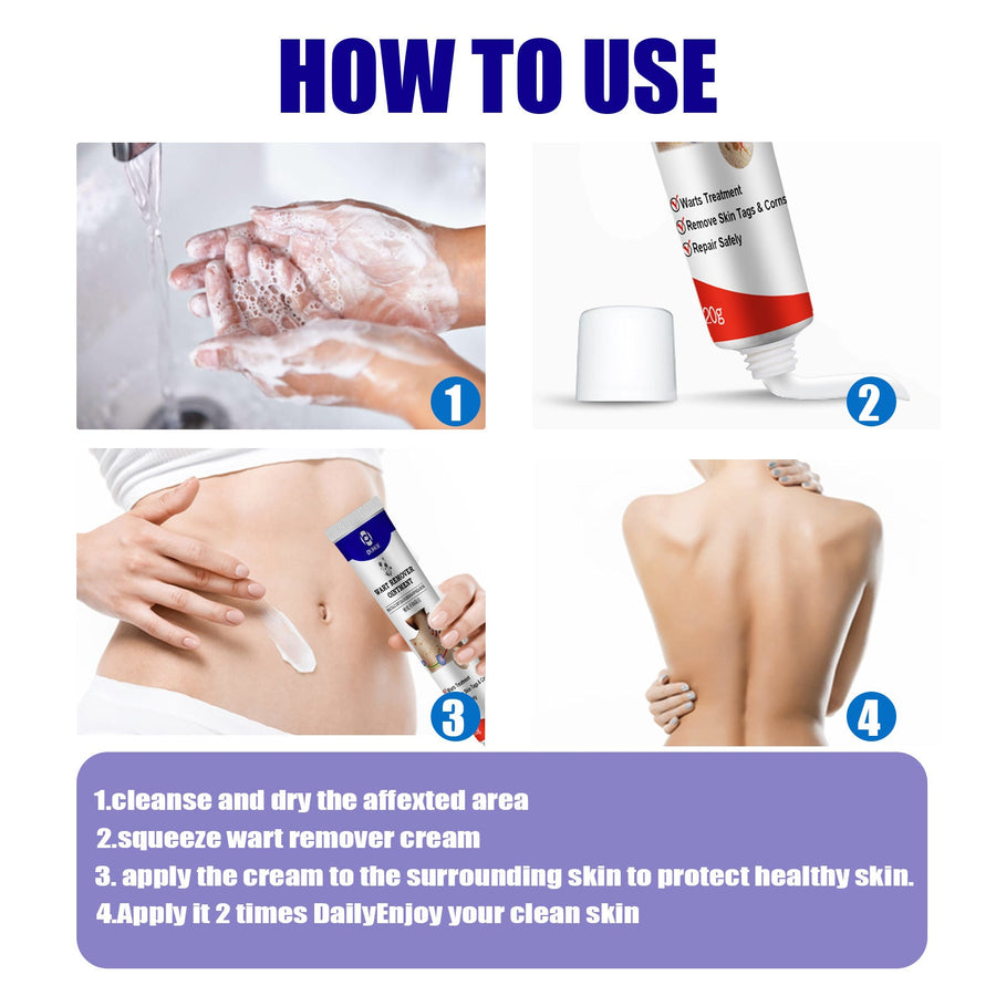 Wart Remover Ointment — Safe Removal of Warts, Skin Tags