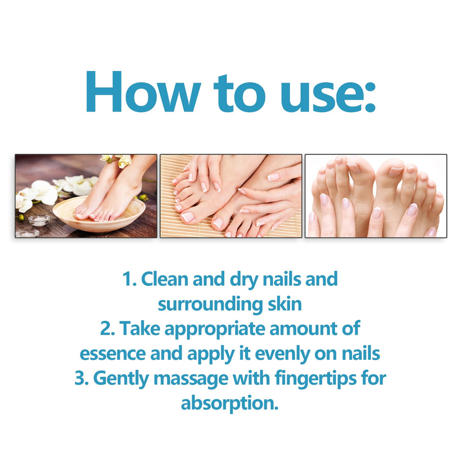 Nail Repair Solution for Thick Discolored Nails