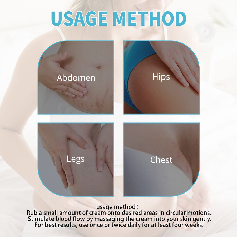 Stretch Mark Repair Cream for Pregnancy Skin Recovery