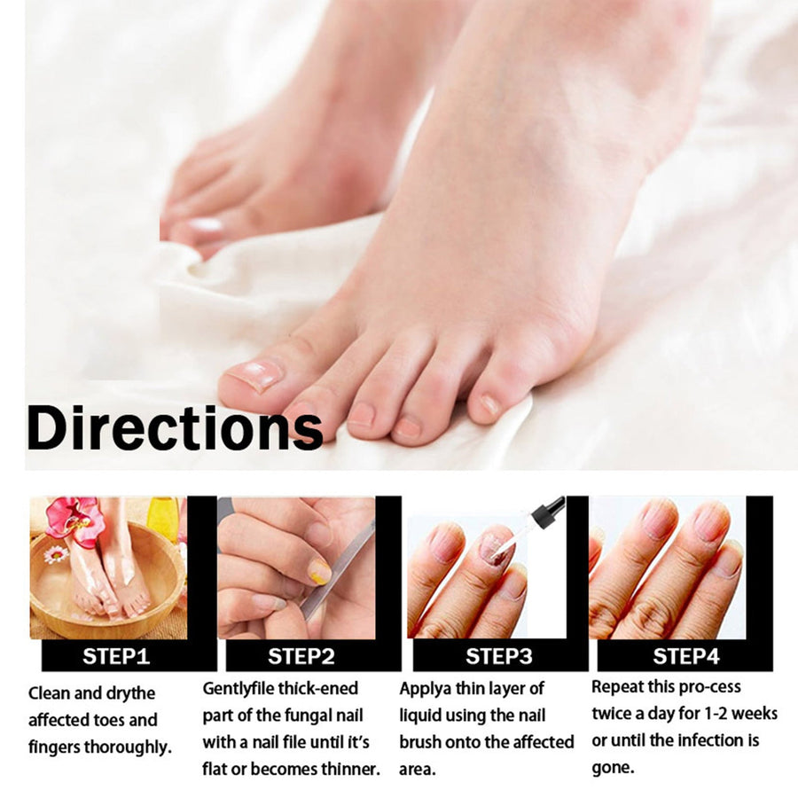 Nail Fungus Treatment Oil — Clear, Healthy Nails in 8 Weeks
