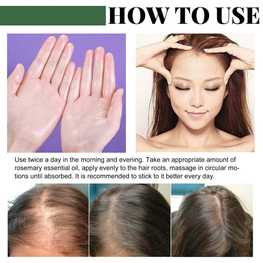 Rosemary Oil Capsules for Stronger, Moisturized Hair