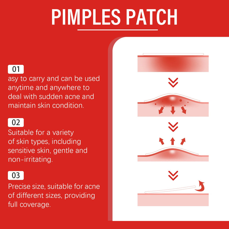 Salicylic Acid Acne Patch Gently Cleanses Facial Skin And Mo