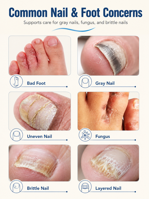 Gray Nail Foot Spray – Gentle Plant‑Based Nail Care