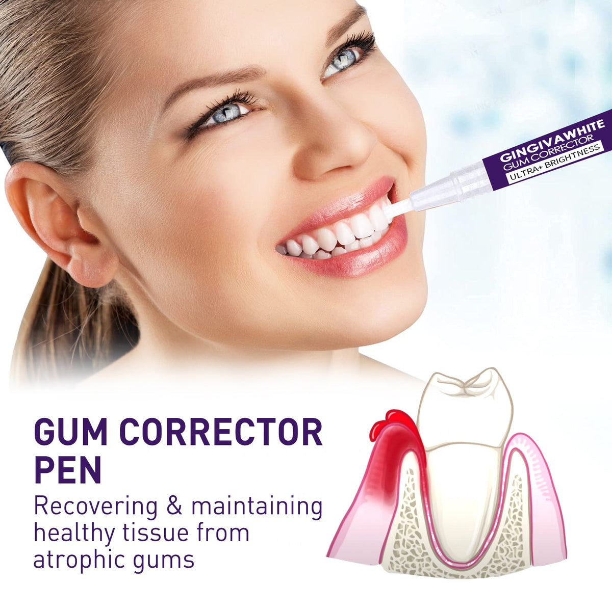 Teeth Whitening Pen for Targeted Gum Care at Home