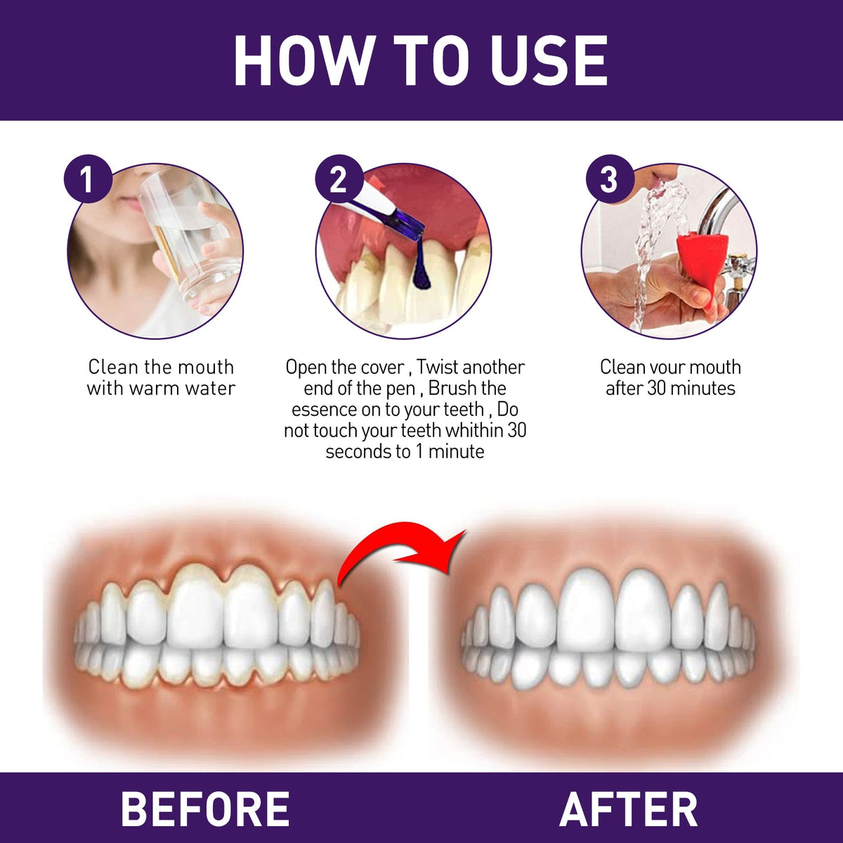 Teeth Whitening Pen for Targeted Gum Care at Home