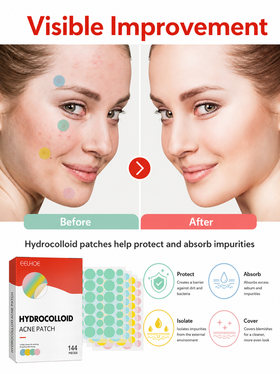 Hydrocolloid Pimple Patches — 144-Piece Set with Visible