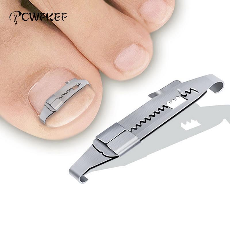 Ingrown Toenail Corrector Brace, Discreet Steel Lift