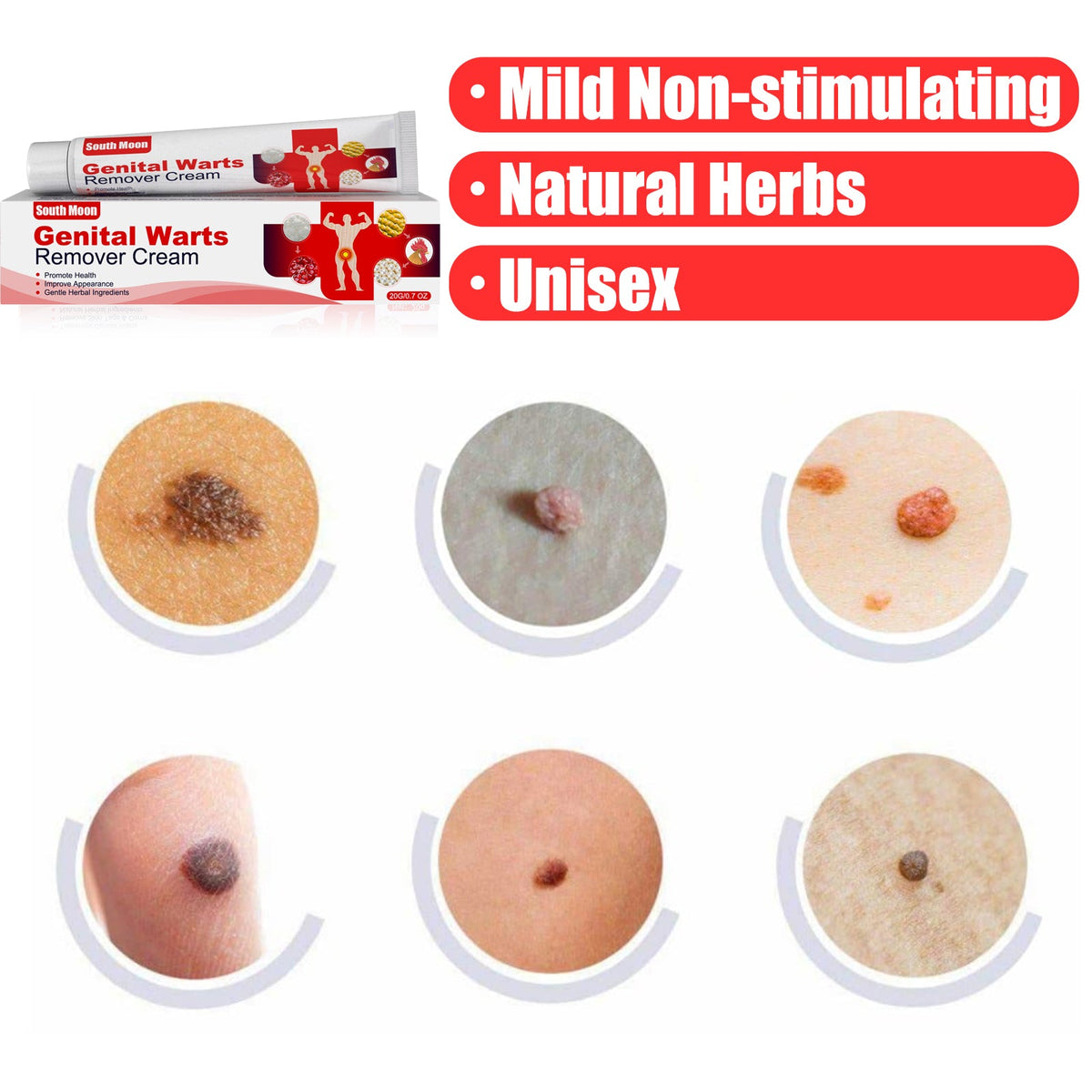 Wart Remover Cream 20g, Gentle Herbal Skin Treatment