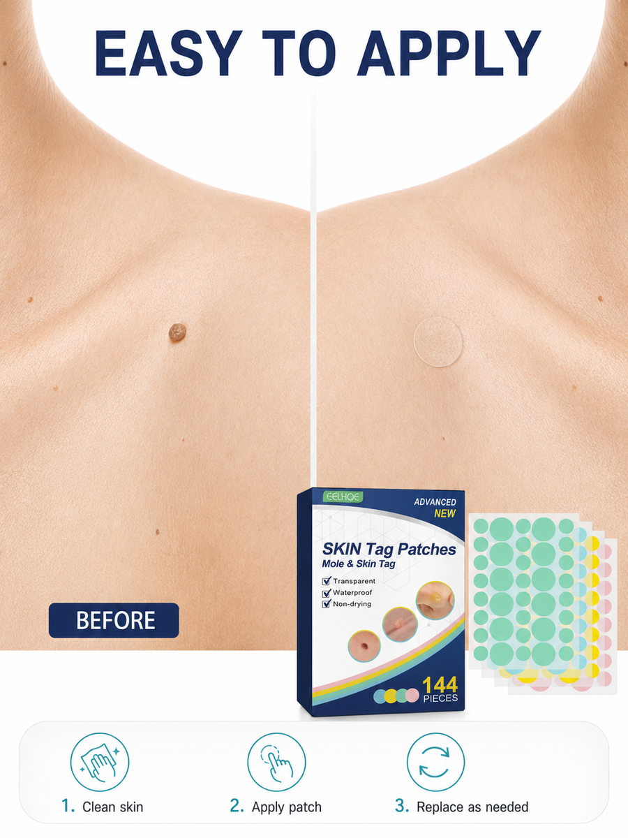 Skin Tag & Mole Removal Patches — 144 Waterproof Patches