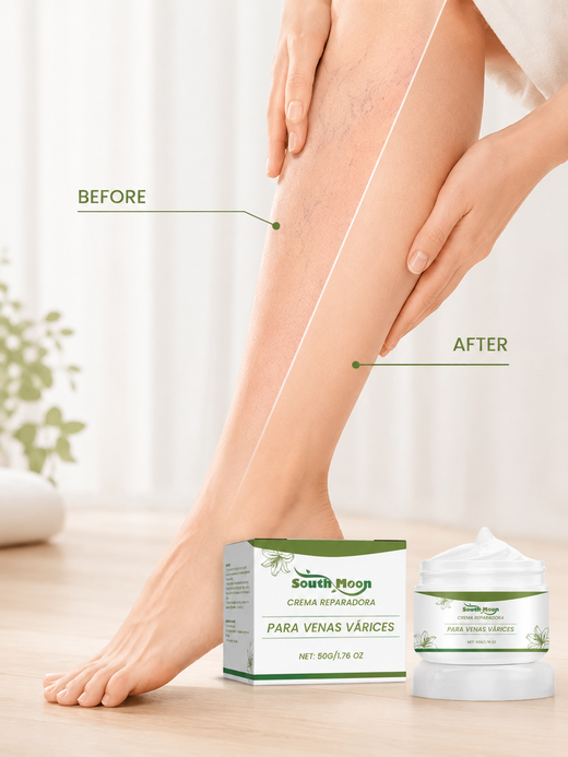 Leg Vein Care Cream — Reduces Varicose Veins & Moisturizes