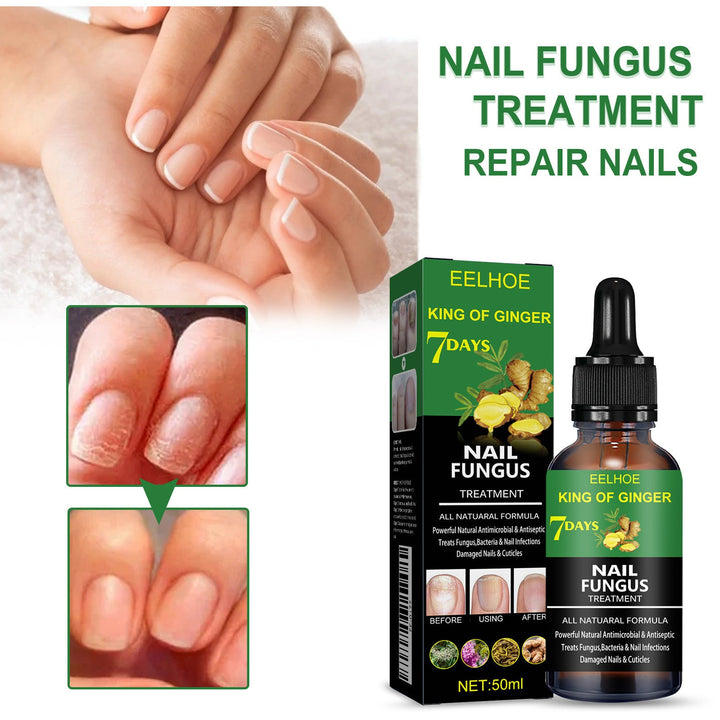 Ginger Nail Care Liquid for Yellowed, Thick Toenails