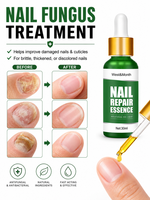 Nail Repair Essence — Anti-Fungal Treatment for Damaged Nails