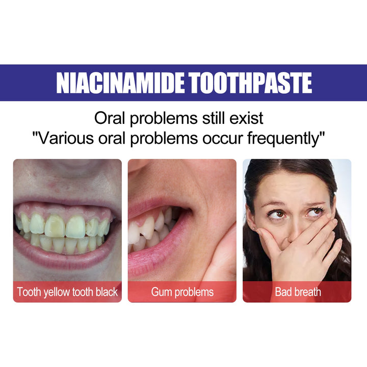 Niacinamide Toothpaste for a Brighter, Fresher Smile