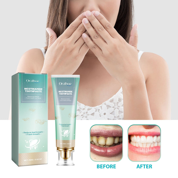 Nicotinamide Toothpaste for Surface Stains & Fresh Breath