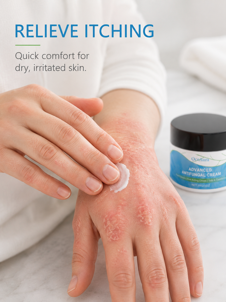 OceAura Antifungal Cream — Plant-Based Itch Relief