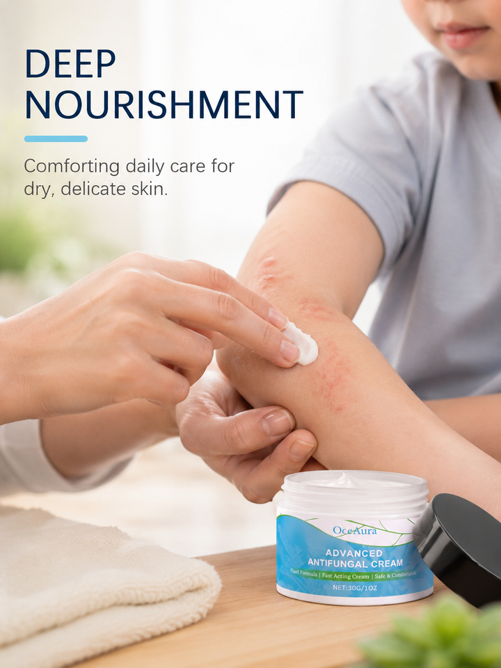 OceAura Antifungal Cream — Plant-Based Itch Relief