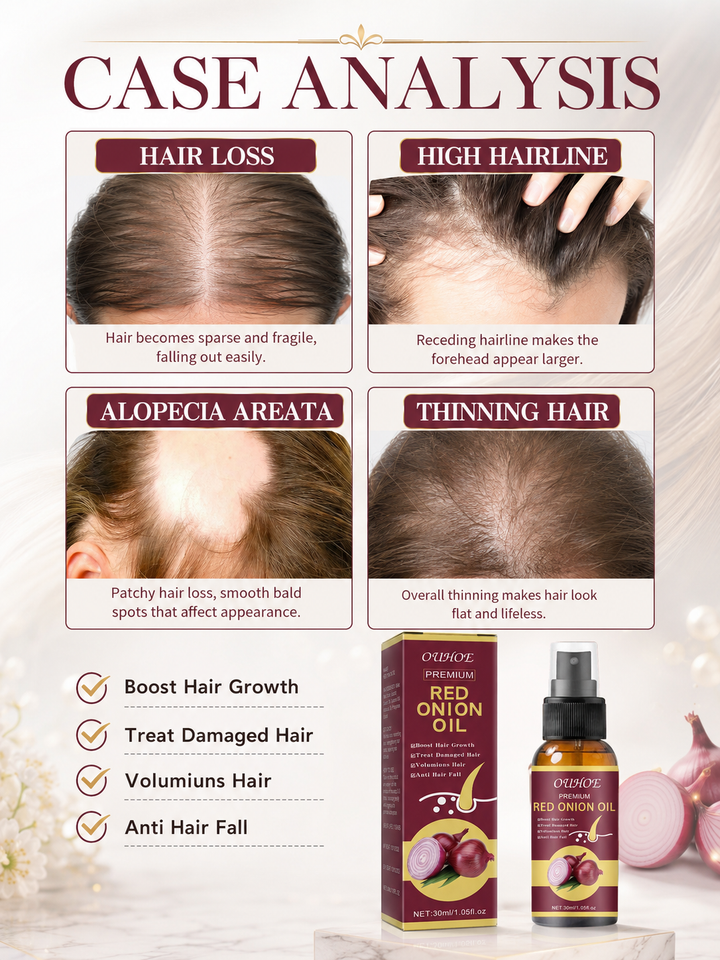 Onion Oil for Hair Growth — Stop Thinning, Boost Volume