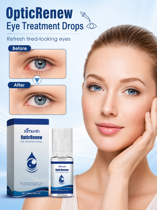 Optic Renew Eye Treatment Drops – Redness Relief & Optic