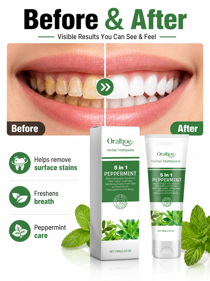 Herbal Whitening Toothpaste – 5-in-1 Peppermint Formula