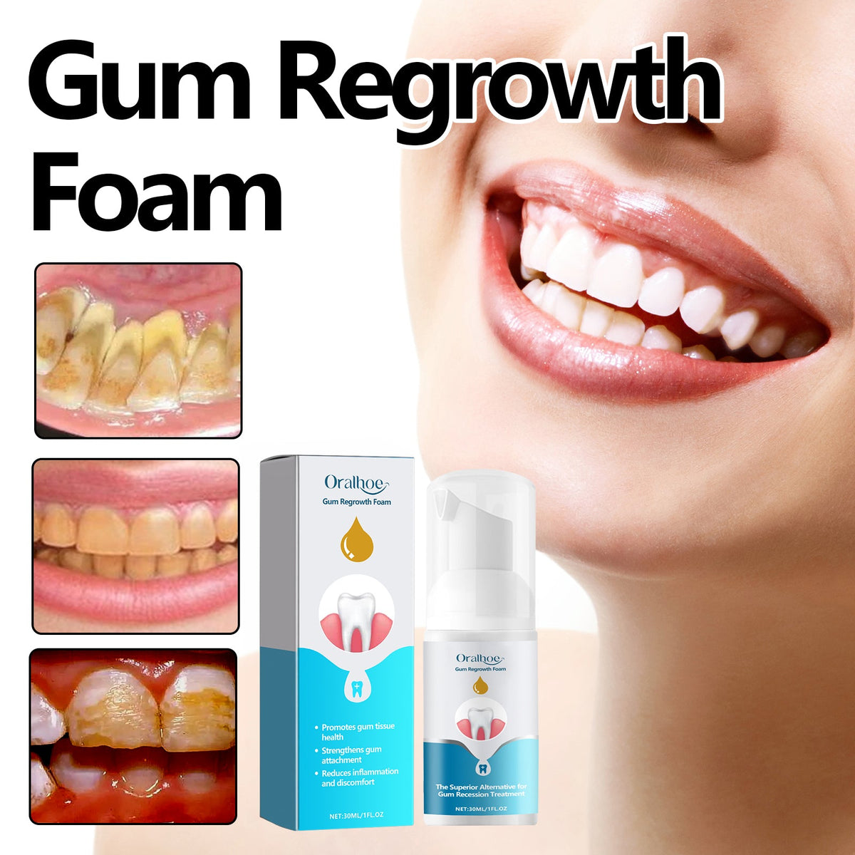 Gum Care Foam for Gum Health, Comfort & Fresh Breath